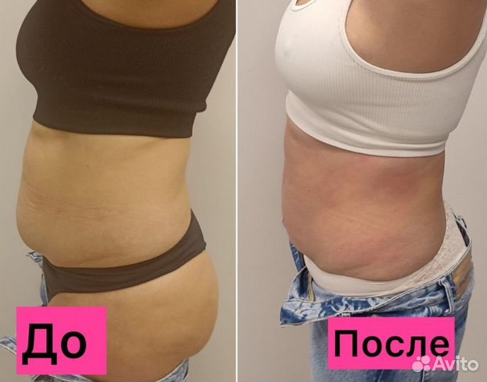 Антицеллюлитный Вибромассаж