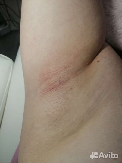 Электроэпиляция,Шугаринг, Чистка лица, массаж лица