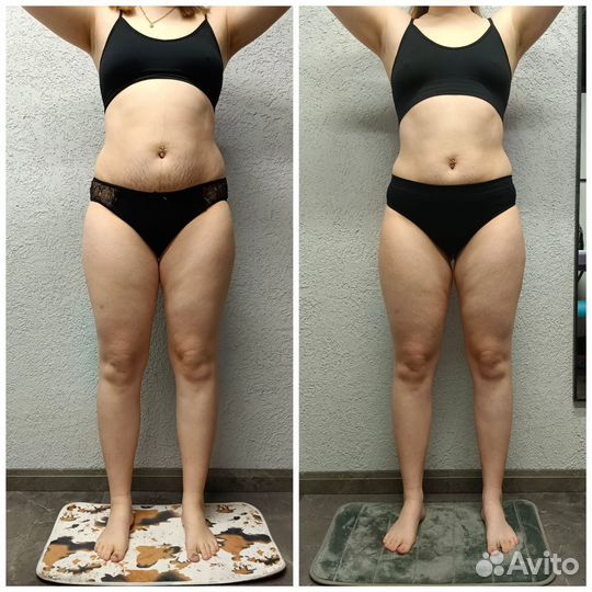 Аппаратный массаж/Вибромассаж