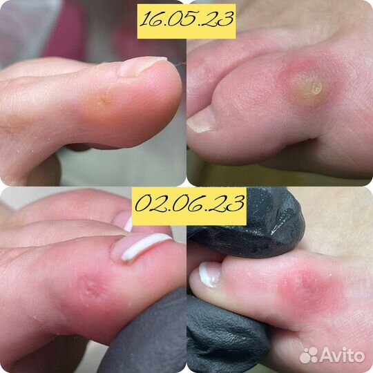 Подолог Волгоград