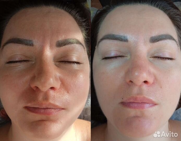 Массаж лица