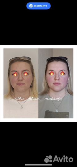 Массаж лица Сплит