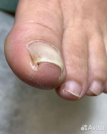 Маникюр педикюр на дому у мастера