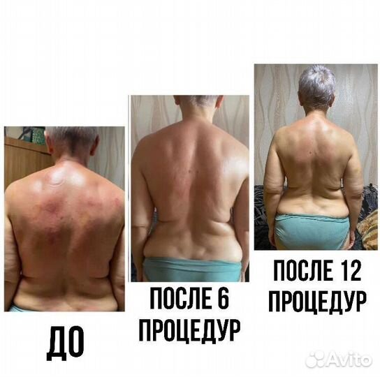 Лечебный массаж