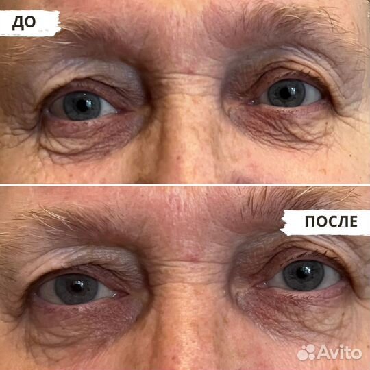 Массаж лица в ЖК Новая Кузничиха