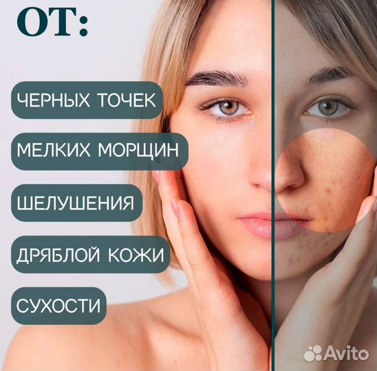 Вакуумный очиститель пор для чистки лица