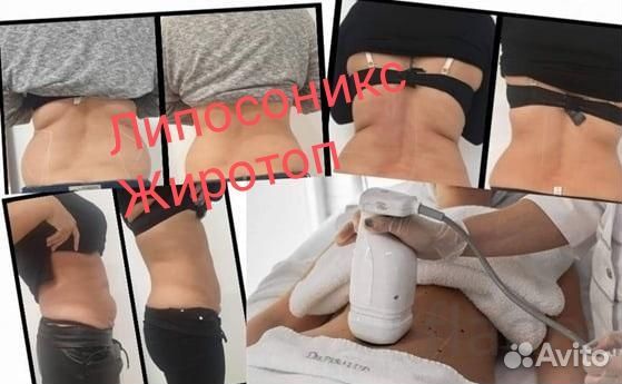 Худеем, Липосоникс, жиротоп