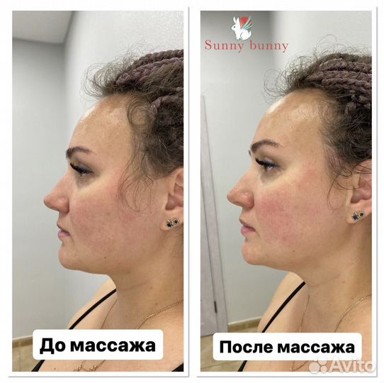 Массаж Противоотёчный, омолаживающий для лица