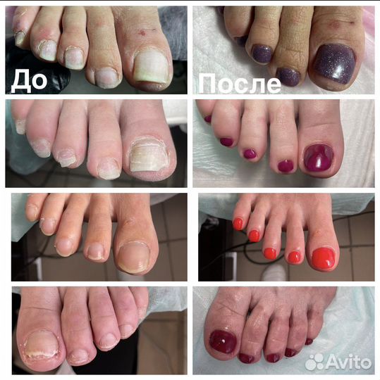 Педикюр, маникюр