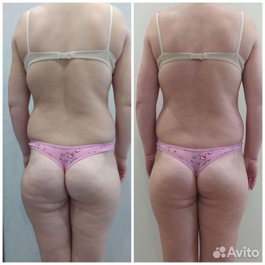 Массаж тело лицо, классика,коррекция фигуры,релакс