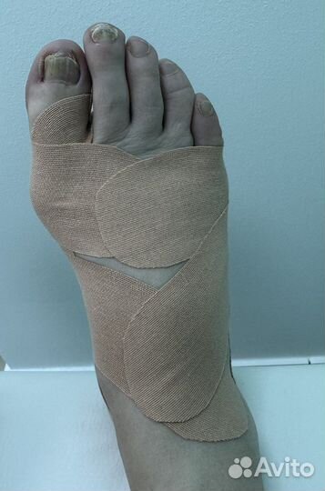 Тейпирование тела