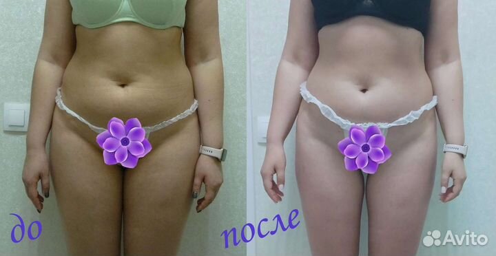 Модель на антицеллюлитный массаж