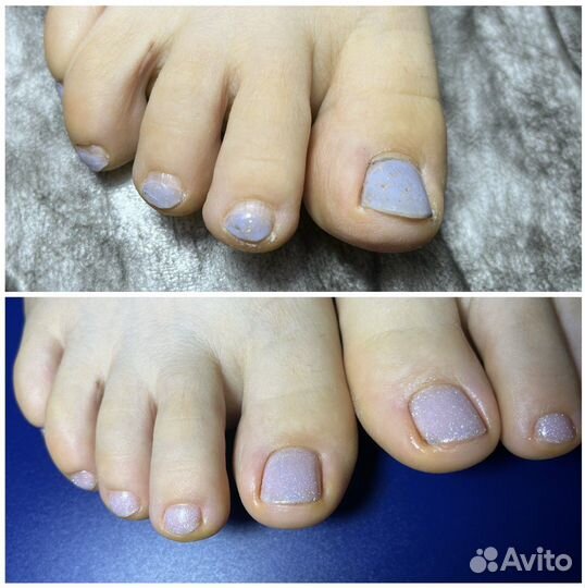 Педикюр + подолог