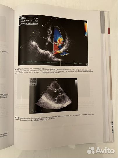 Кардиология