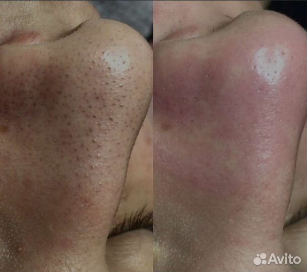 Услуги косметолога