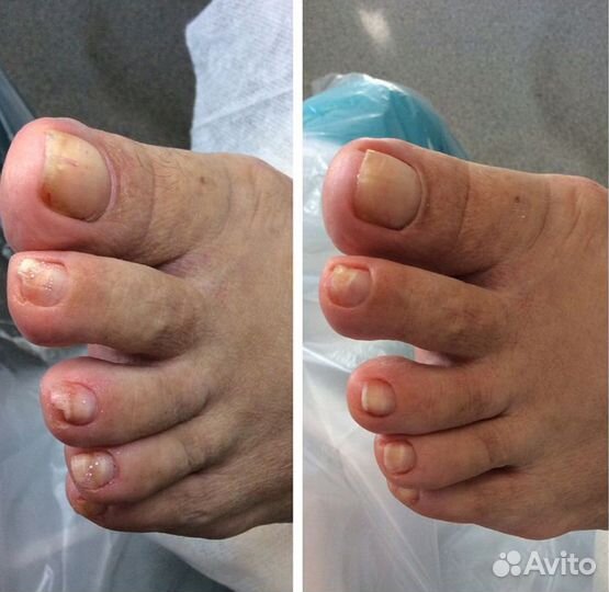 Маникюр, аппаратный педикюр