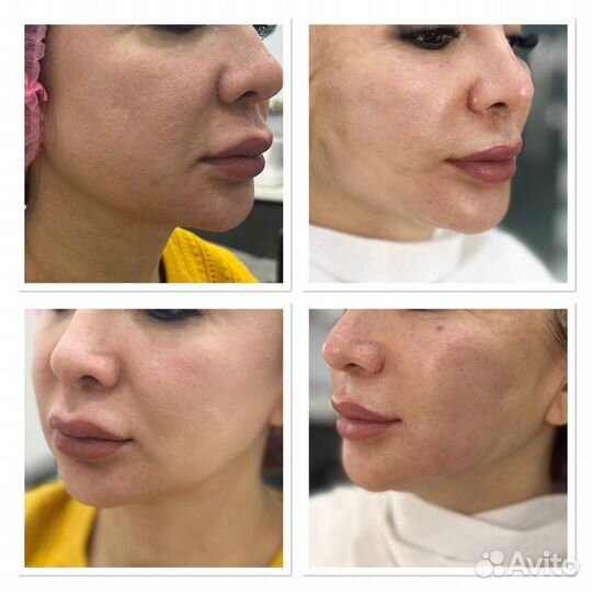 Модель на нити