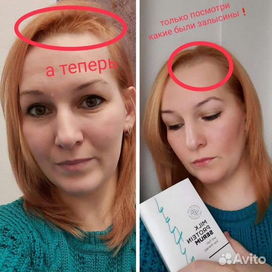 Сыворотка от выпадения волос