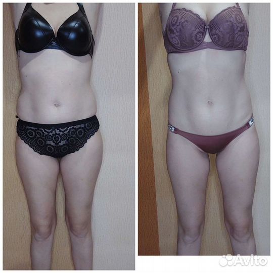 Аппаратный массаж