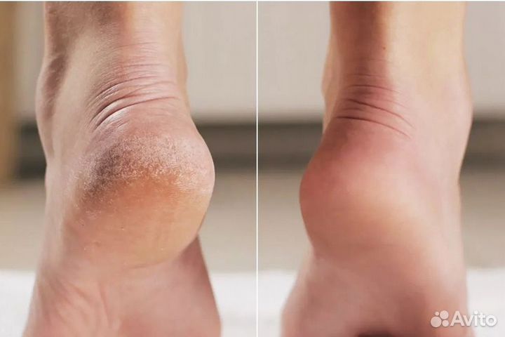 Педикюр спа