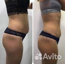 Аппаратный массаж. Коррекция, похудение