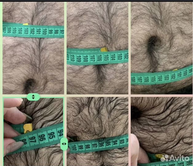 Новая технология похудения Криолиполиз