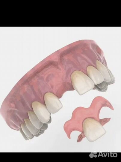 Услуги зубного техника