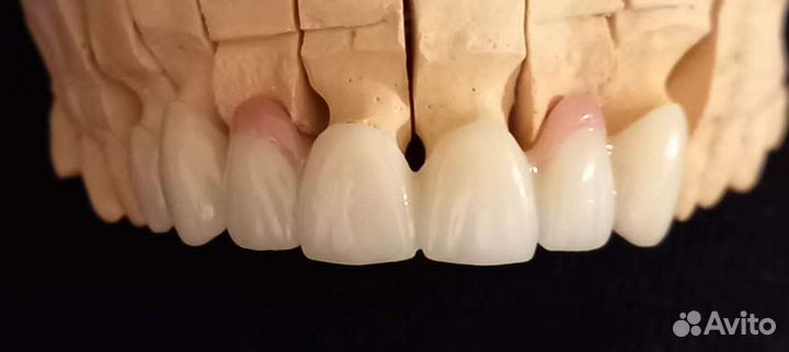 Зуботехнические услуги