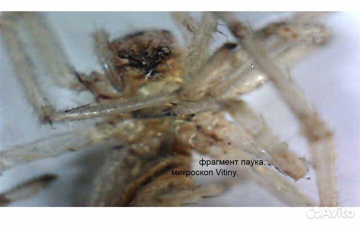 Цифровой USB микроскоп MV600UM2 (трихоскоп)