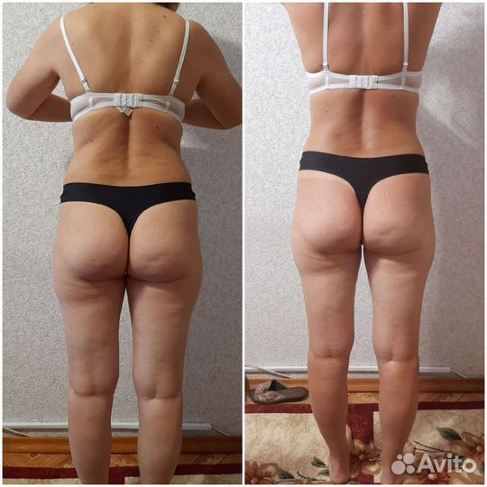 Массаж на дому