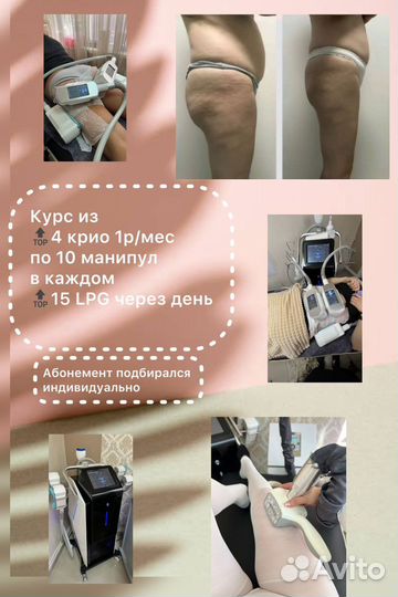 Криолиполиз