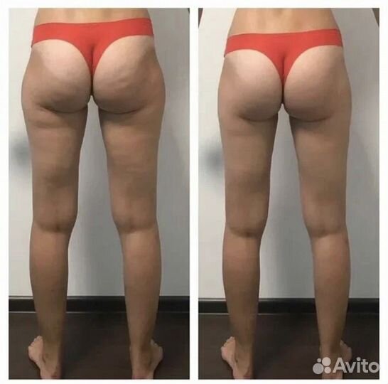 Лучший Массаж в Кудрово