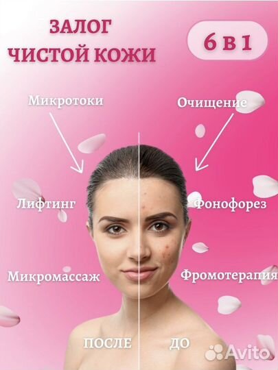 Ультрозвуковой аппарат для чистки лица