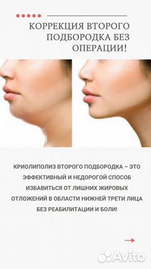 Криолиполиз