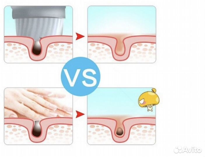 Электрическая щетка для чистки лица