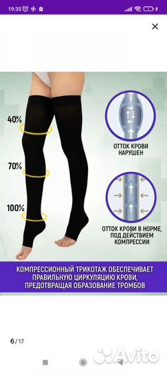 Компрессионные чулки 1 класс