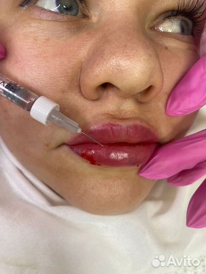 Врач - косметолог