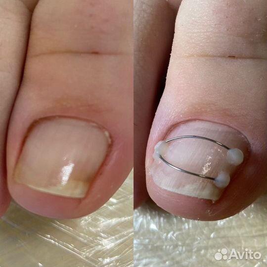 Маникюр Наращивание ногтей, покрытие гель-лаком