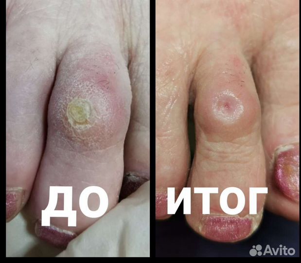 Подолог опытный