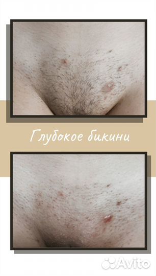 Шугаринг (выезд на дом).Мужчинам не беспокоить