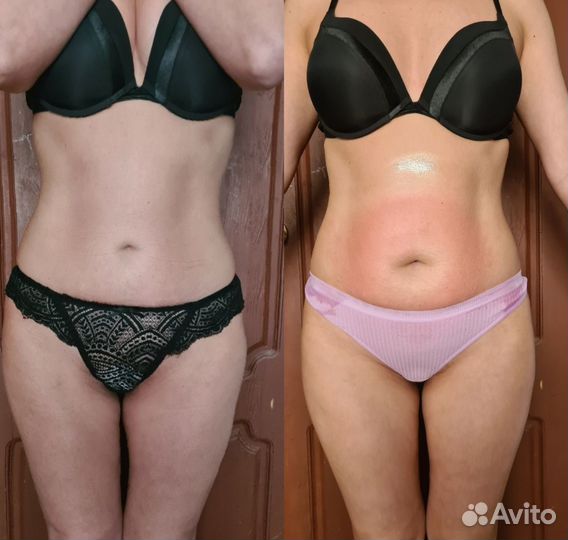 Коррекция Тела, лица Микротоки, кавитация,Вакуум