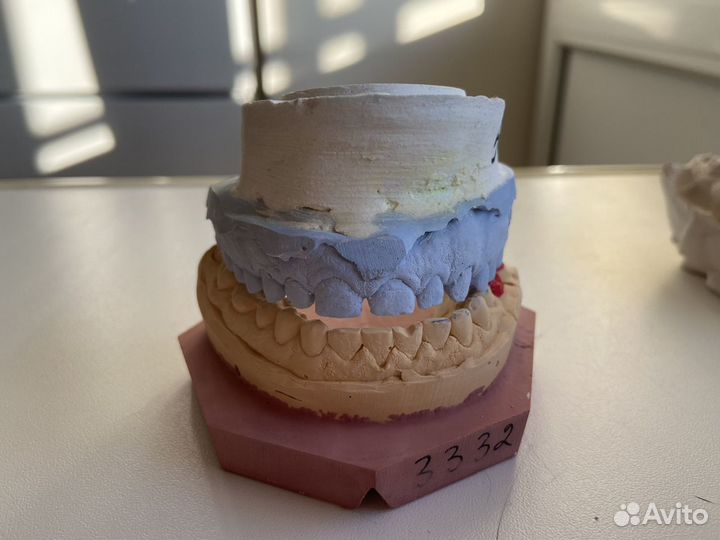 Гипсовые слепки челюсти