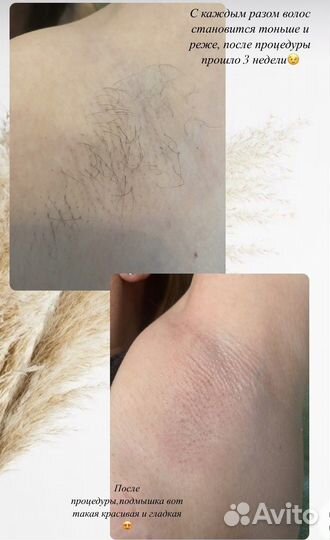 Мастер шугаринга