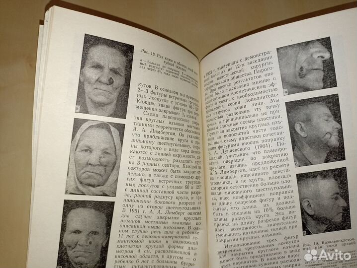 Первичные восстановительные операции при лечении о