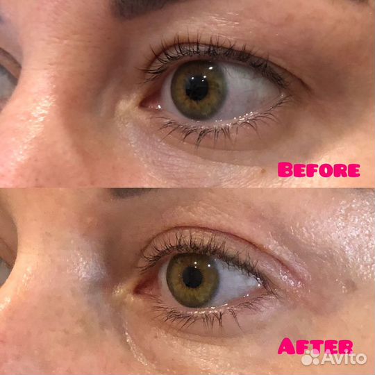 Холодная плазма/обучение