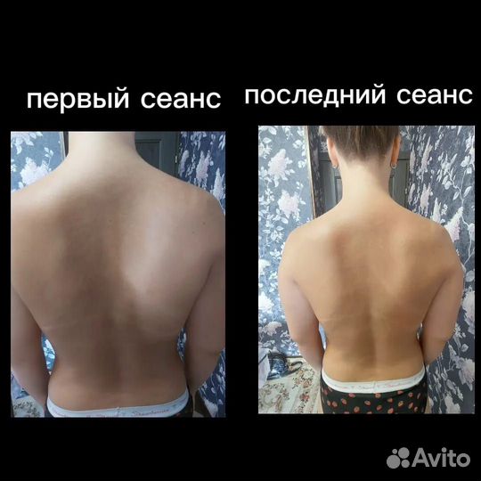 Массажистка на дому