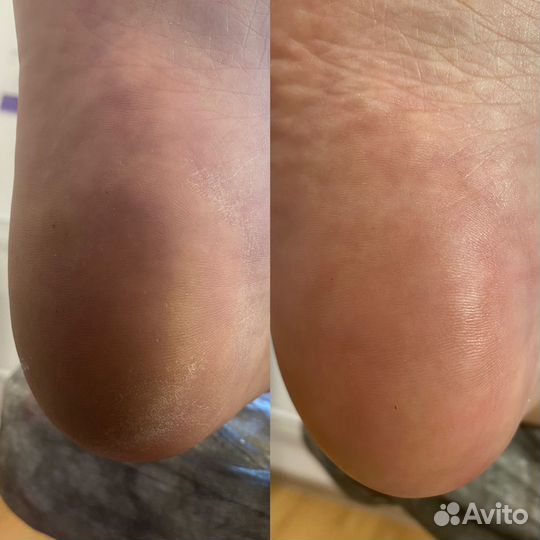 Модели на педикюр