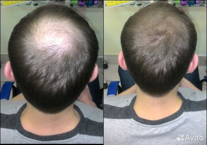 Загуститель для волос