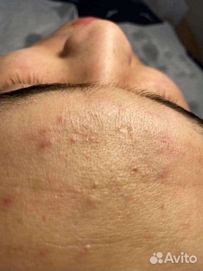 Услуги косметолога