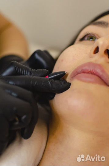 Микротерм электроэпилятор Микро Терм Обучение